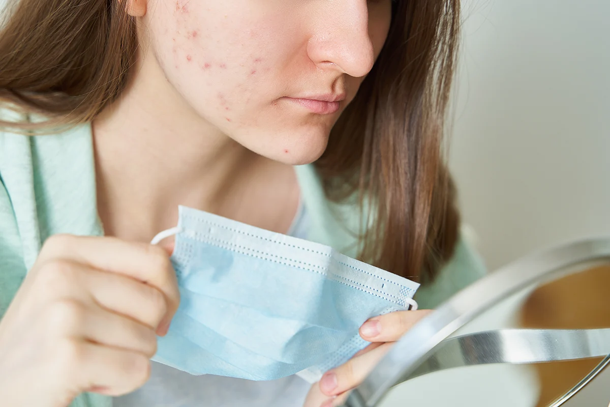 Maskne: What Is It? How Do I Prevent It?